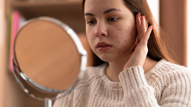 7 Natural Ways to Slim Down Your Face – Effective for a More Sculpted Look